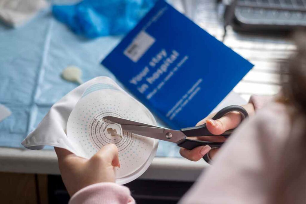 Ostomy pouch. Photo courtesy of SolStock